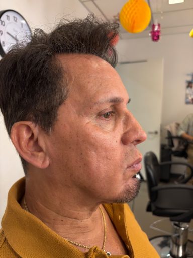 Model 1: Before - Lace Piece