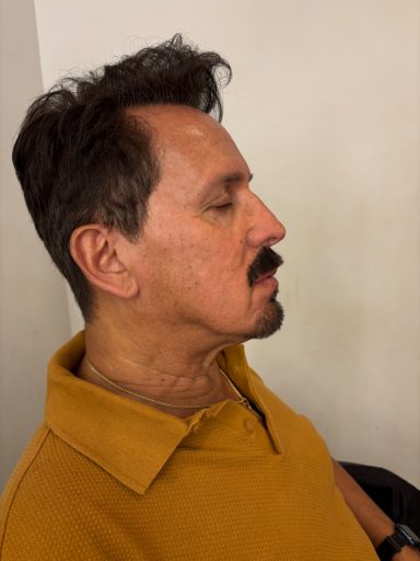 Model 1: After - Hand-Laid