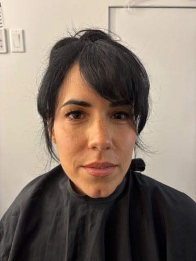 Scar/Cut/Bruise: Before