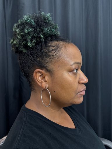 Freezing Weather - Before