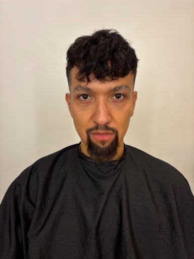 Model 2: After - Lace Piece