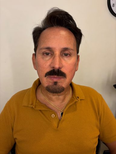 Model 1: After - Hand-Laid