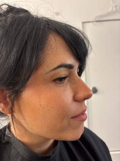 Scar/Cut/Bruise: Before