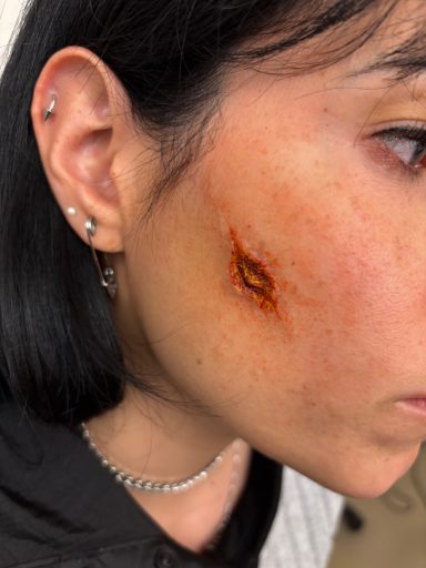 Scar/Cut/Bruise: Progress