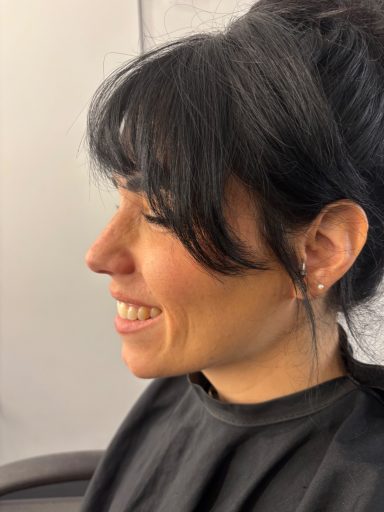 Scar/Cut/Bruise: Before