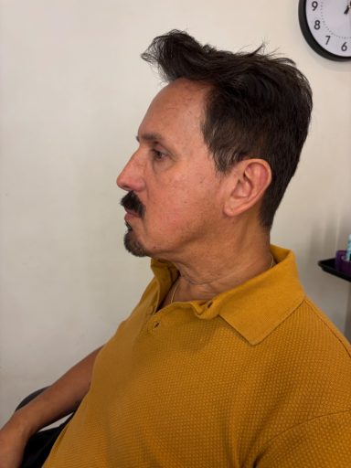 Model 1: After - Hand-Laid