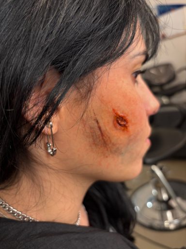 Scar/Cut/Bruise: After